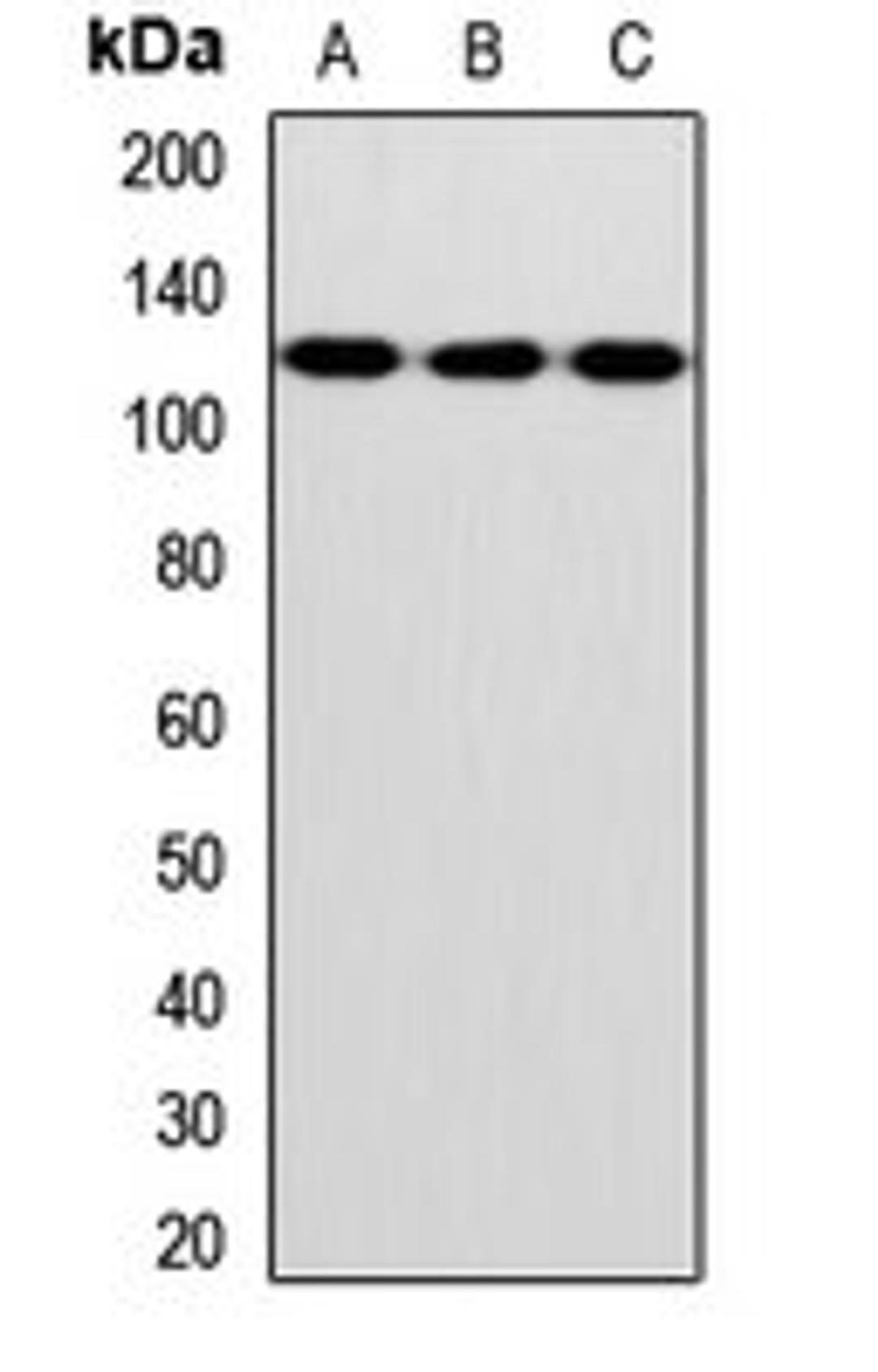 Western blot analysis of K562 (Lane1), mouse liver (Lane2), mouse kidney (Lane3) whole cell lysates using INVS antibody