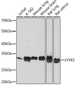 Western blot - LYVE1 Rabbit mAb (A4352)