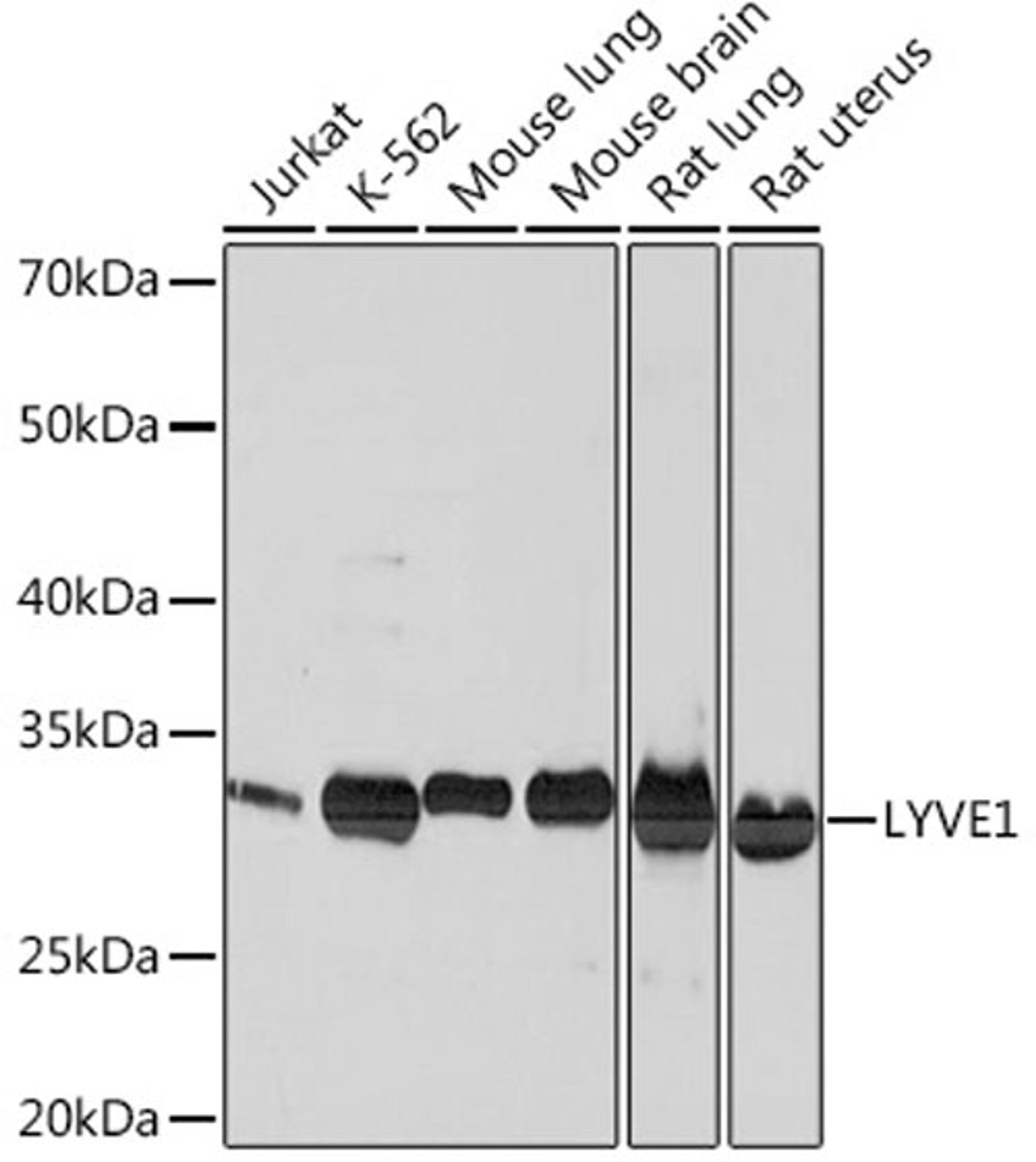 Western blot - LYVE1 Rabbit mAb (A4352)