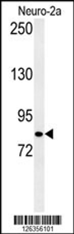 Western blot analysis of CQ028 Antibody in Neuro-2a cell line lysates (35ug/lane)