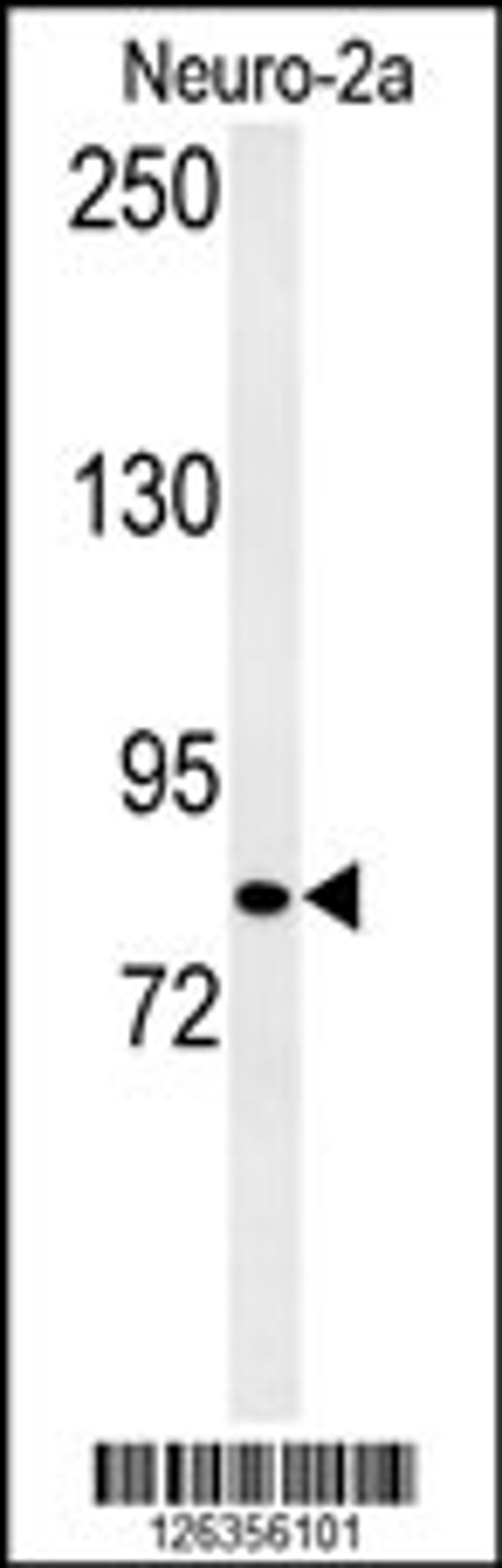 Western blot analysis of CQ028 Antibody in Neuro-2a cell line lysates (35ug/lane)