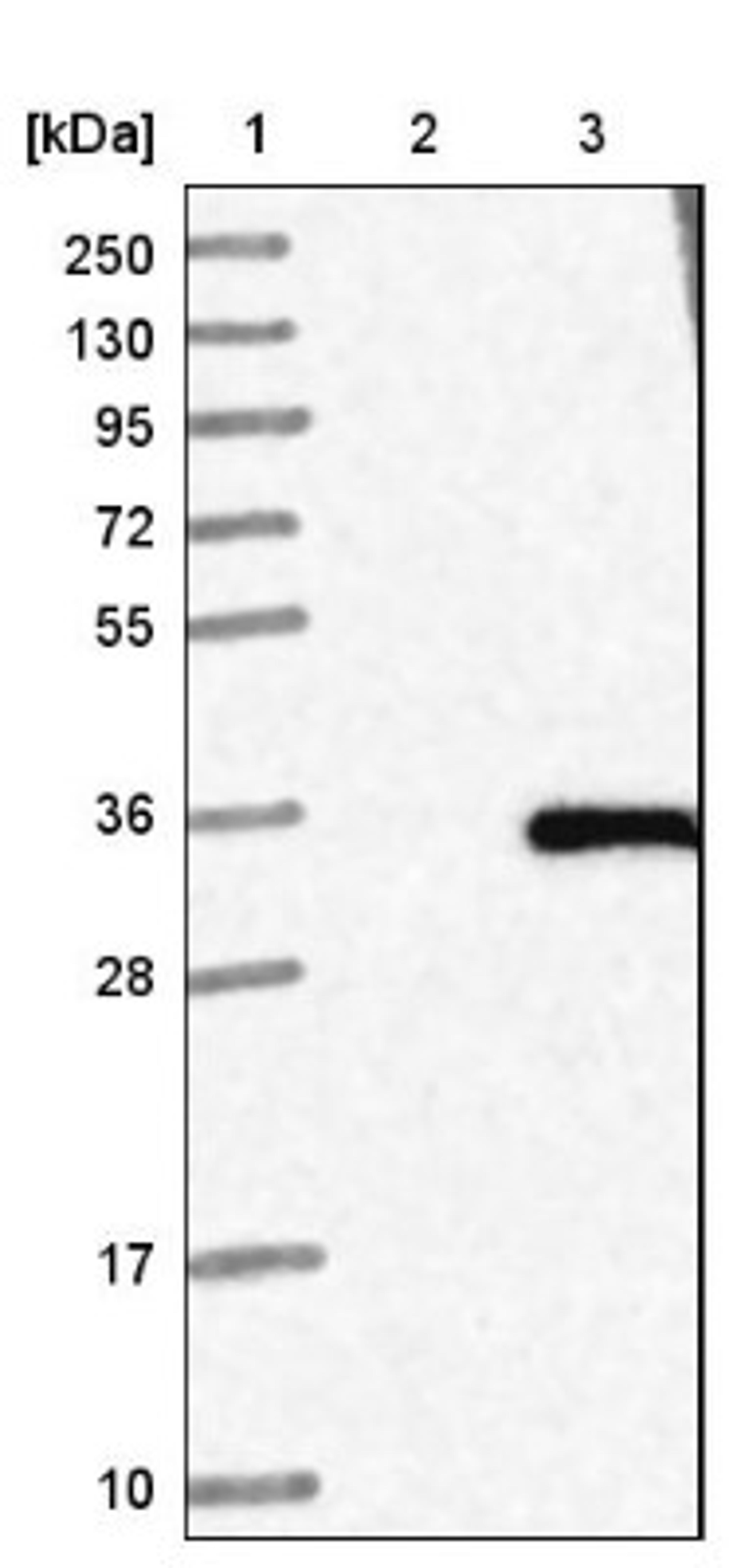 Western Blot: HSD17B3 Antibody [NBP1-80776] - Lane 1: Marker [kDa] 250, 130, 95, 72, 55, 36, 28, 17, 10<br/>Lane 2: Negative control (vector only transfected HEK293T lysate)<br/>Lane 3: Over-expression lysate (Co-expressed with a C-terminal myc-DDK tag (~3.1 kDa) in mammalian HEK293T cells, LY424871)