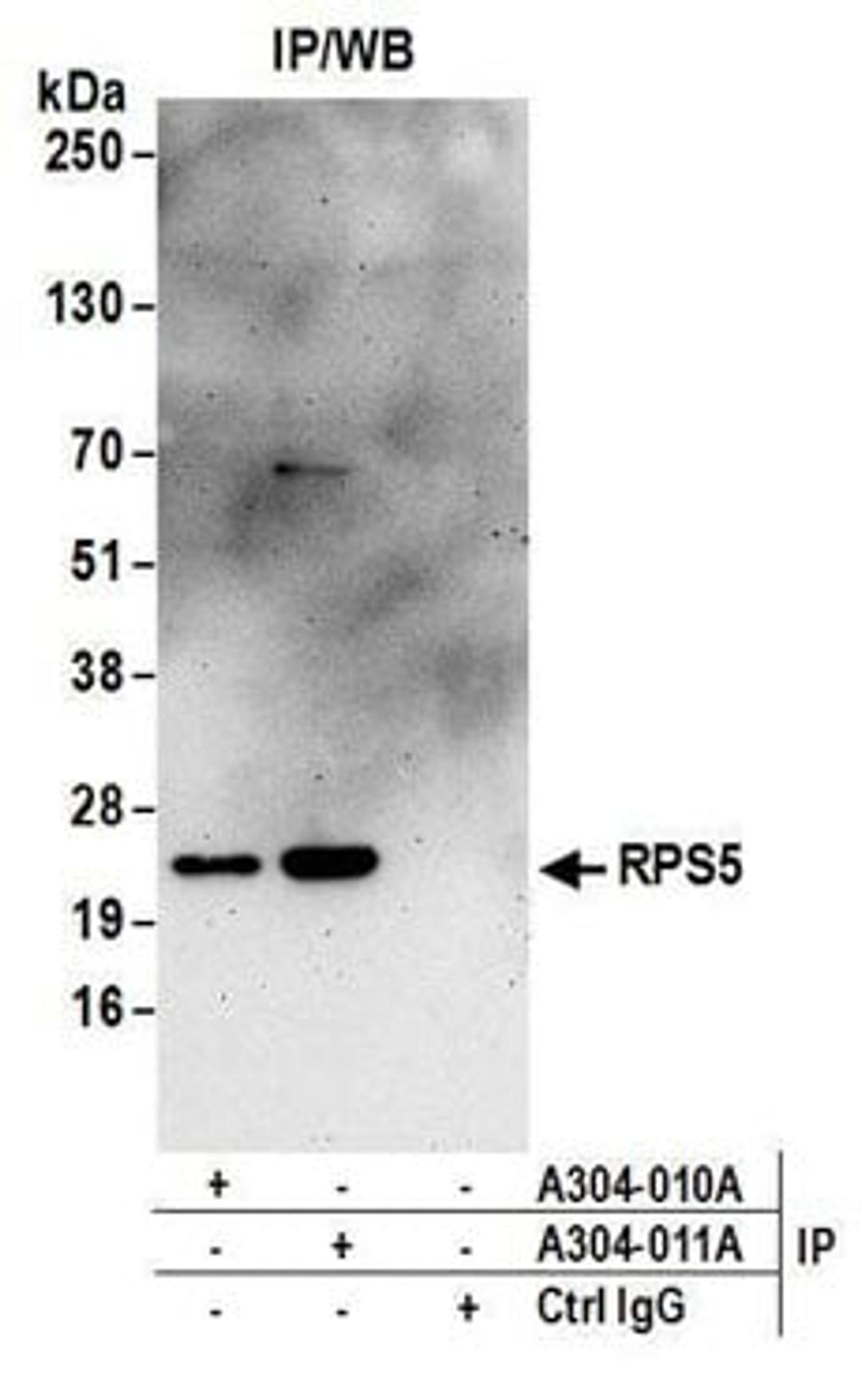 Detection of human RPS5 by western blot of immunoprecipitates.