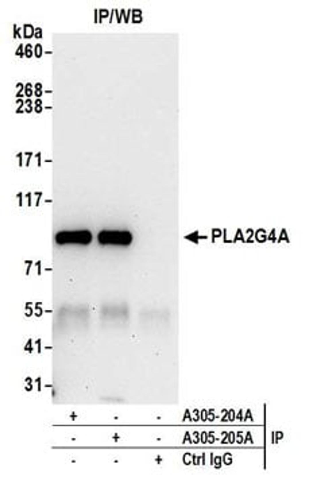 Detection of human PLA2G4A by western blot of immunoprecipitates.