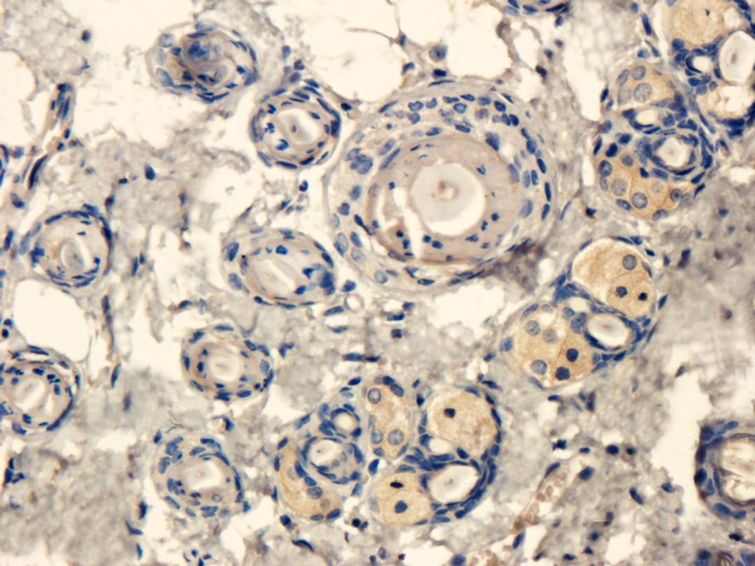 IHC-P image of mouse kidney tissue using anti-CXCL11 (dilution of primary antibody at 1:100)