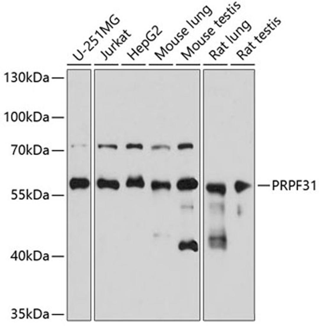 Western blot - PRPF31 antibody (A5732)