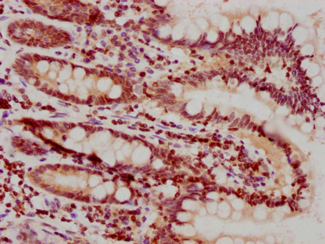 IHC image of CSB-PA010378PA25nhibHU diluted at 1:10 and staining in paraffin-embedded human small intestine tissue performed on a Leica BondTM system. After dewaxing and hydration, antigen retrieval was mediated by high pressure in a citrate buffer (pH 6.0). Section was blocked with 10% normal goat serum 30min at RT. Then primary antibody (1% BSA) was incubated at 4°C overnight. The primary is detected by a biotinylated secondary antibody and visualized using an HRP conjugated SP system.