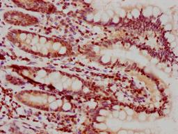 IHC image of CSB-PA010378PA25nhibHU diluted at 1:10 and staining in paraffin-embedded human small intestine tissue performed on a Leica BondTM system. After dewaxing and hydration, antigen retrieval was mediated by high pressure in a citrate buffer (pH 6.0). Section was blocked with 10% normal goat serum 30min at RT. Then primary antibody (1% BSA) was incubated at 4°C overnight. The primary is detected by a biotinylated secondary antibody and visualized using an HRP conjugated SP system.