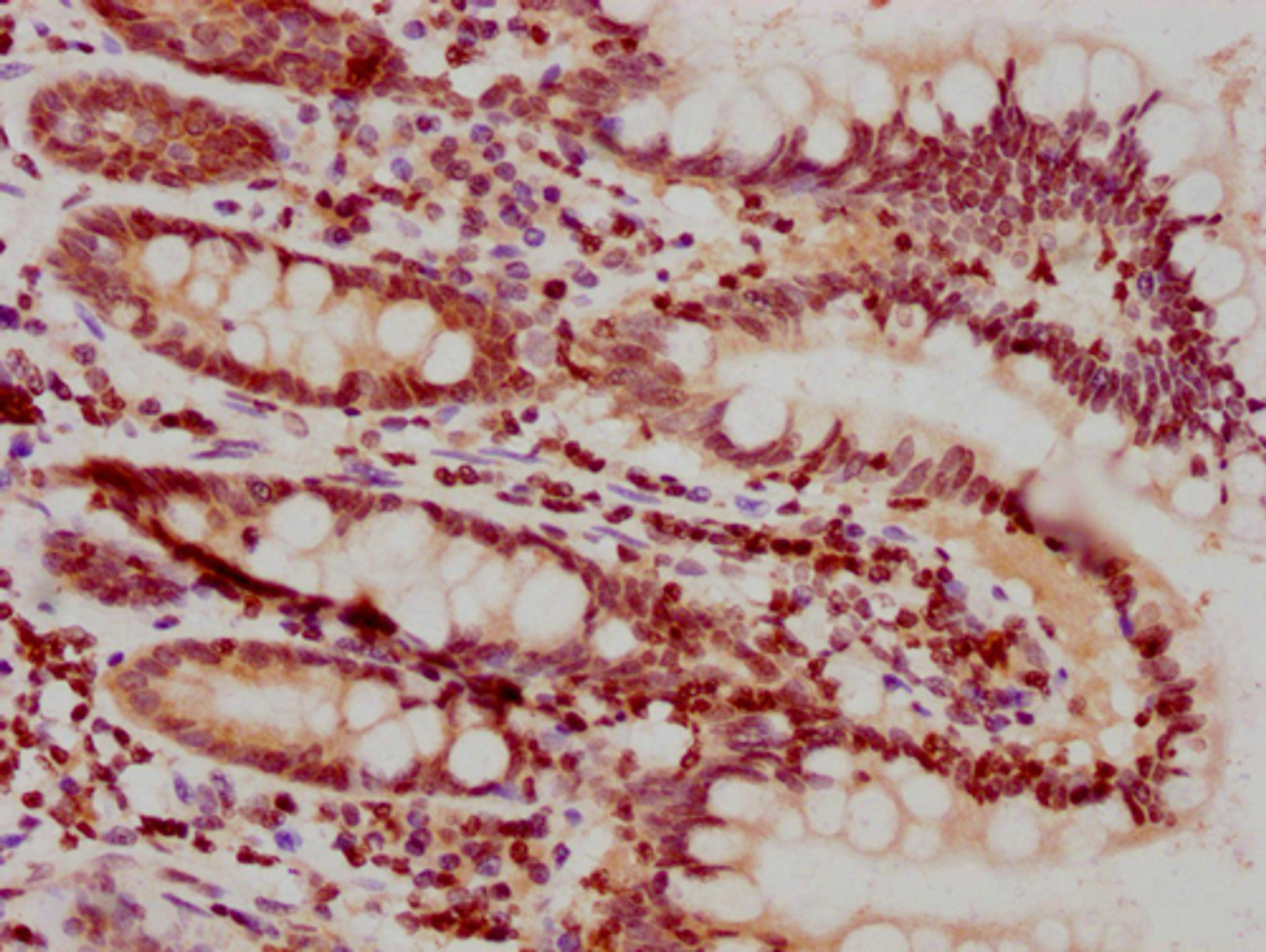 IHC image of CSB-PA010378PA25nhibHU diluted at 1:10 and staining in paraffin-embedded human small intestine tissue performed on a Leica BondTM system. After dewaxing and hydration, antigen retrieval was mediated by high pressure in a citrate buffer (pH 6.0). Section was blocked with 10% normal goat serum 30min at RT. Then primary antibody (1% BSA) was incubated at 4°C overnight. The primary is detected by a biotinylated secondary antibody and visualized using an HRP conjugated SP system.