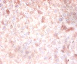 Immunohistochemistry of paraffin-embedded mouse liver tissue using CSB-PA007083LA01HU at dilution of 1:100