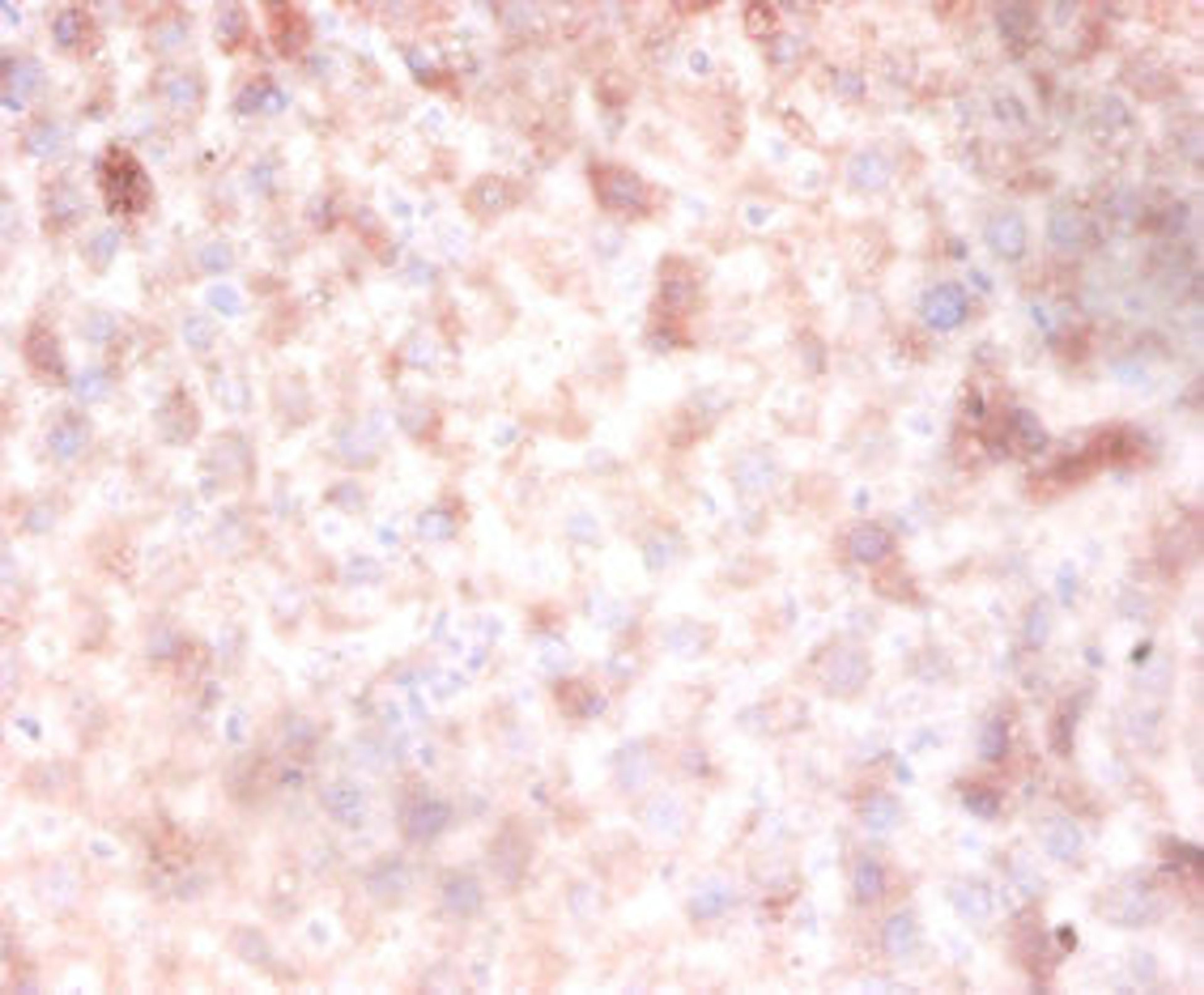 Immunohistochemistry of paraffin-embedded mouse liver tissue using CSB-PA007083LA01HU at dilution of 1:100