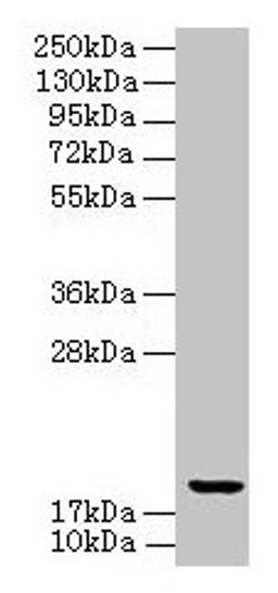 Western blot. All lanes: UBE2G2 antibody at 8µg/ml + K562 whole cell lysate. Secondary. Goat polyclonal to rabbit IgG at 1/10000 dilution. Predicted band size: 19, 16 kDa. Observed band size: 19 kDa
