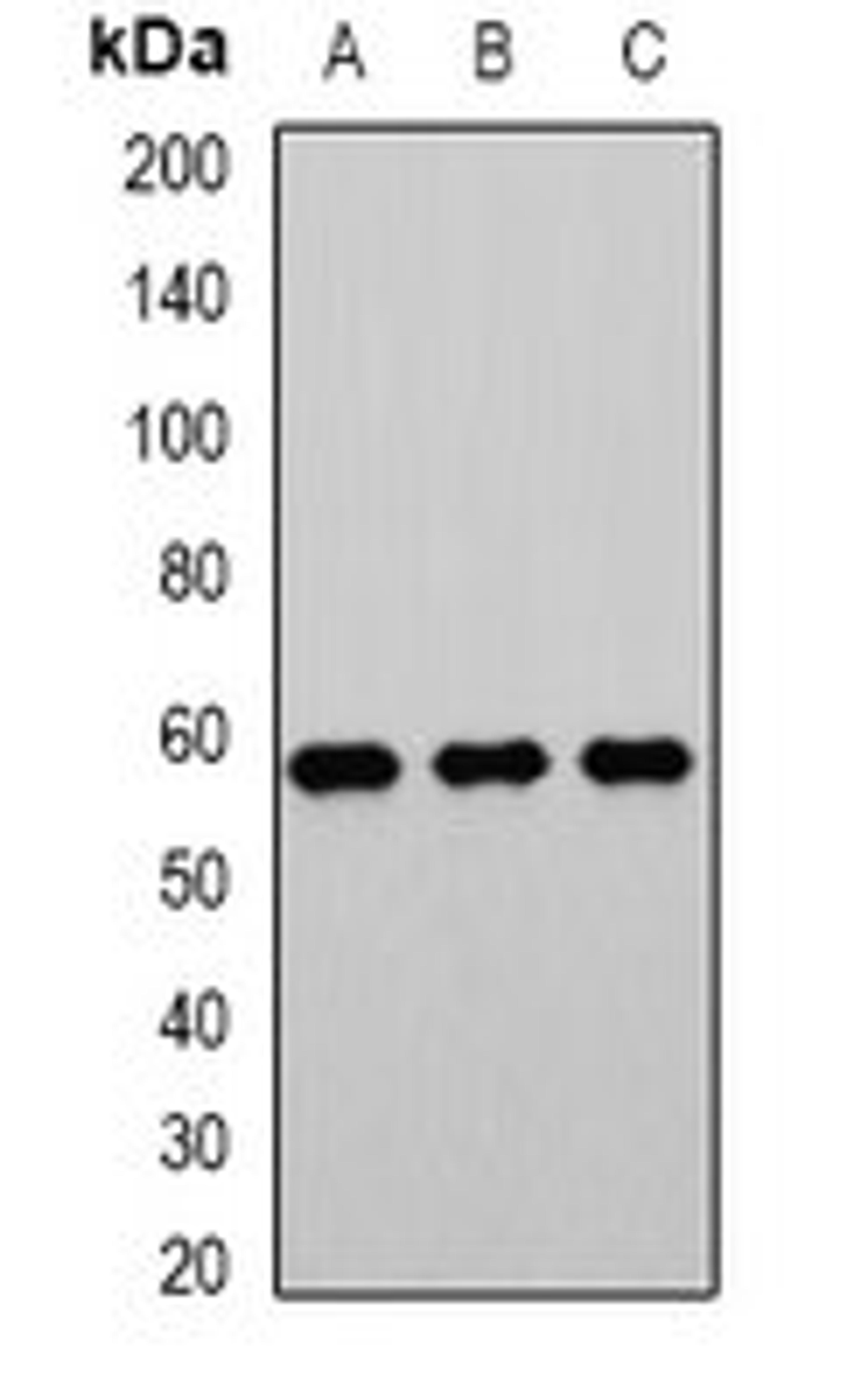 Western blot analysis of Jurkat (Lane1), mouse testis (Lane2), rat kidney (Lane3) whole cell lysates using ACCS antibody