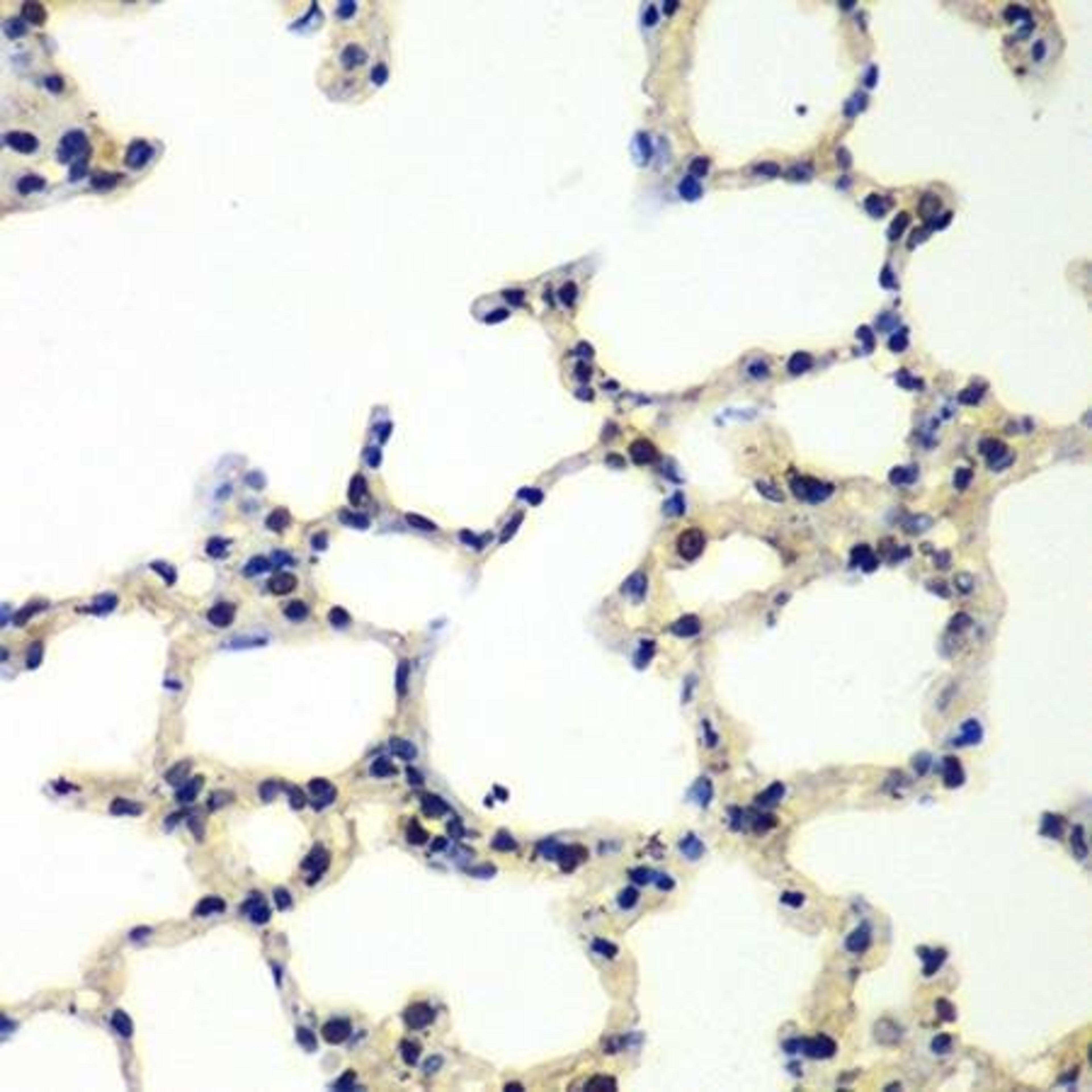 Immunohistochemical staining of rat lung tissue using PNKP antibody