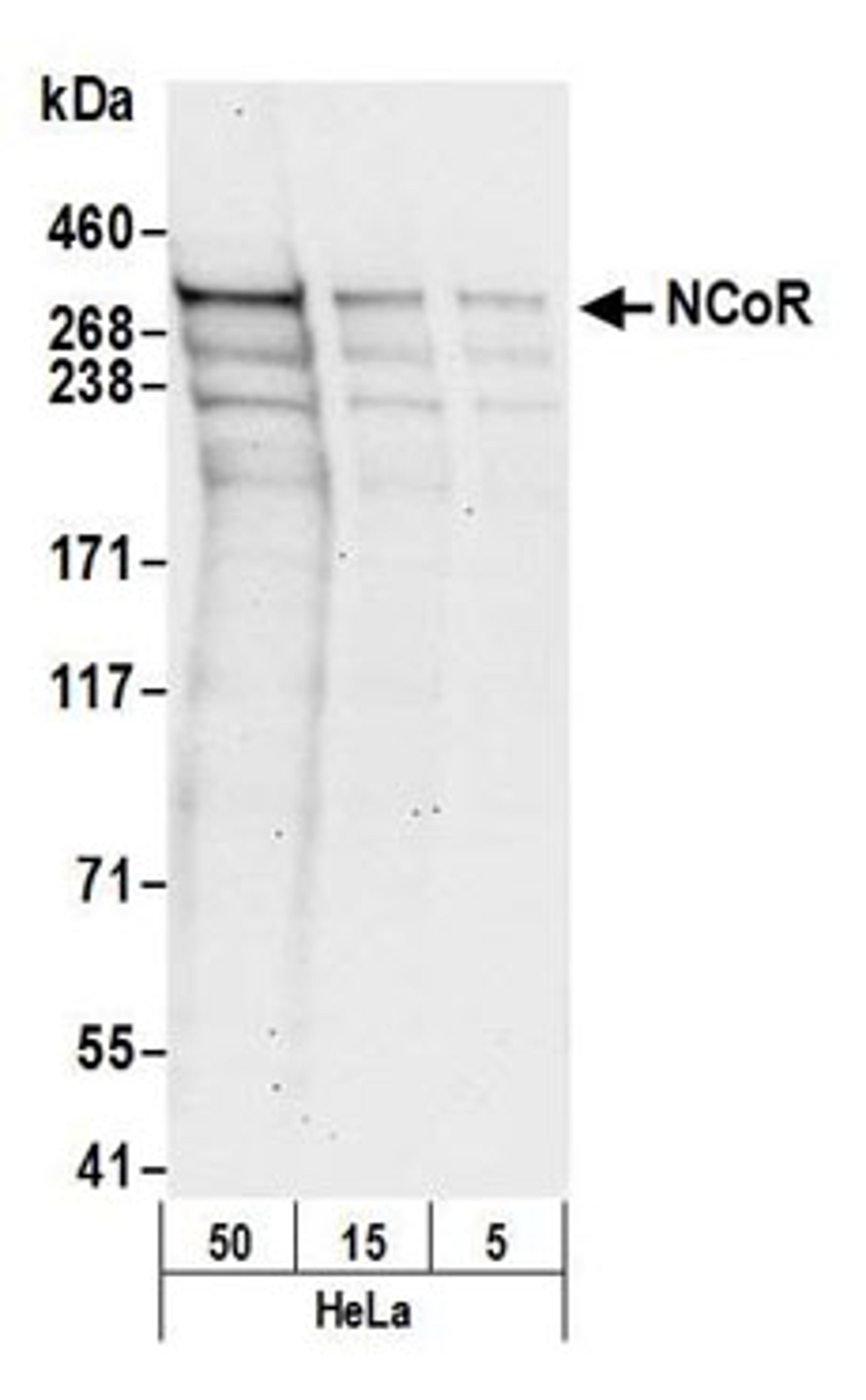 Detection of human NCoR by western blot.