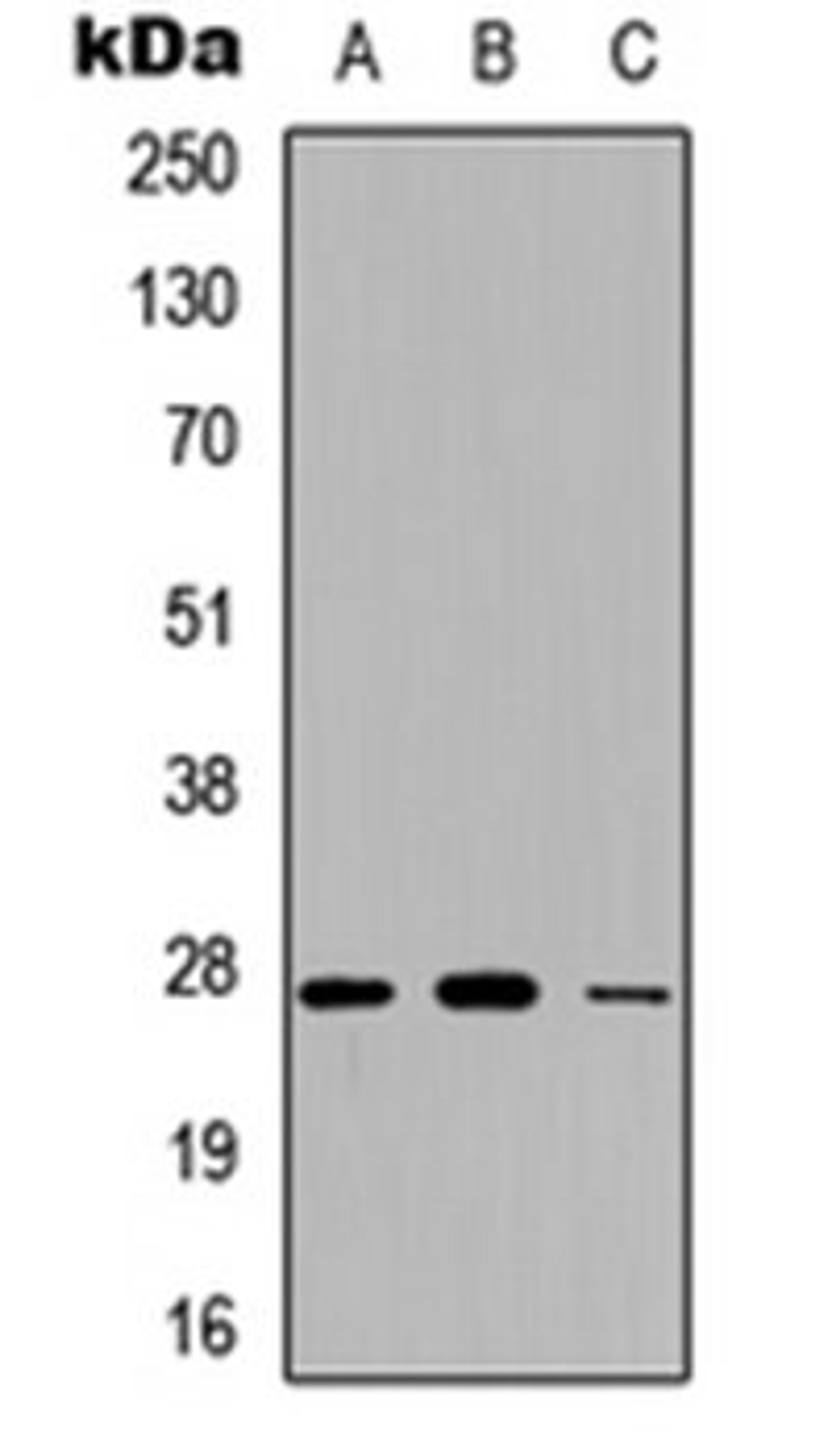 Western blot analysis of A549 (Lane 1), NS-1 (Lane 2), PC12 (Lane 3) whole cell lysates using Adipsin antibody