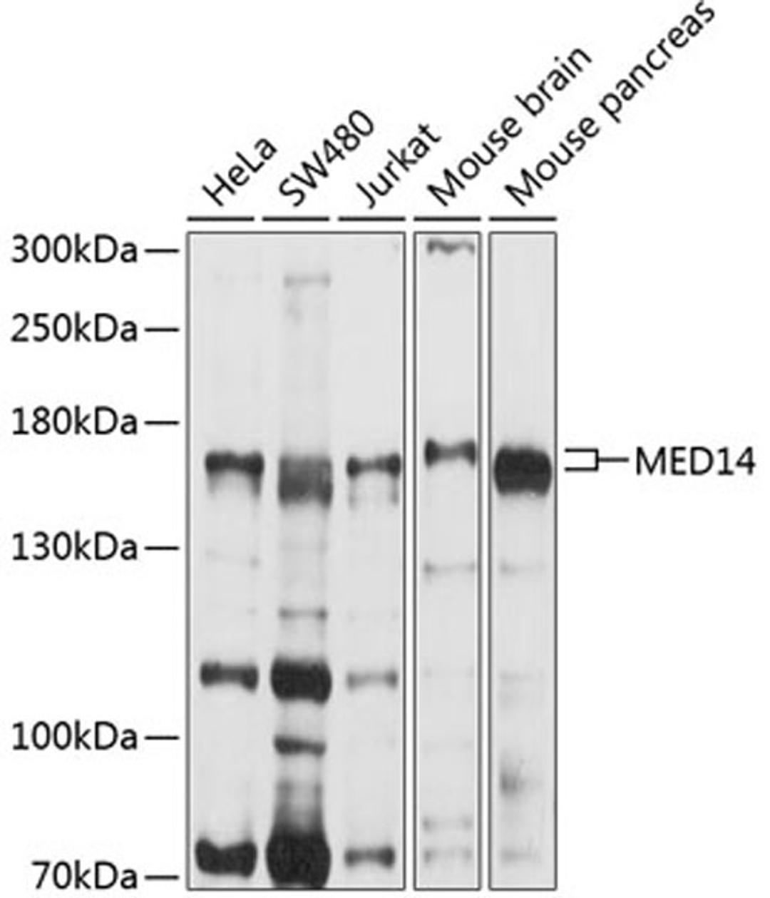 Western blot - MED14 antibody (A10455)