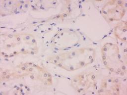 Immunohistochemical staining of human kidney tissue using Aquaporin 5 antibody.