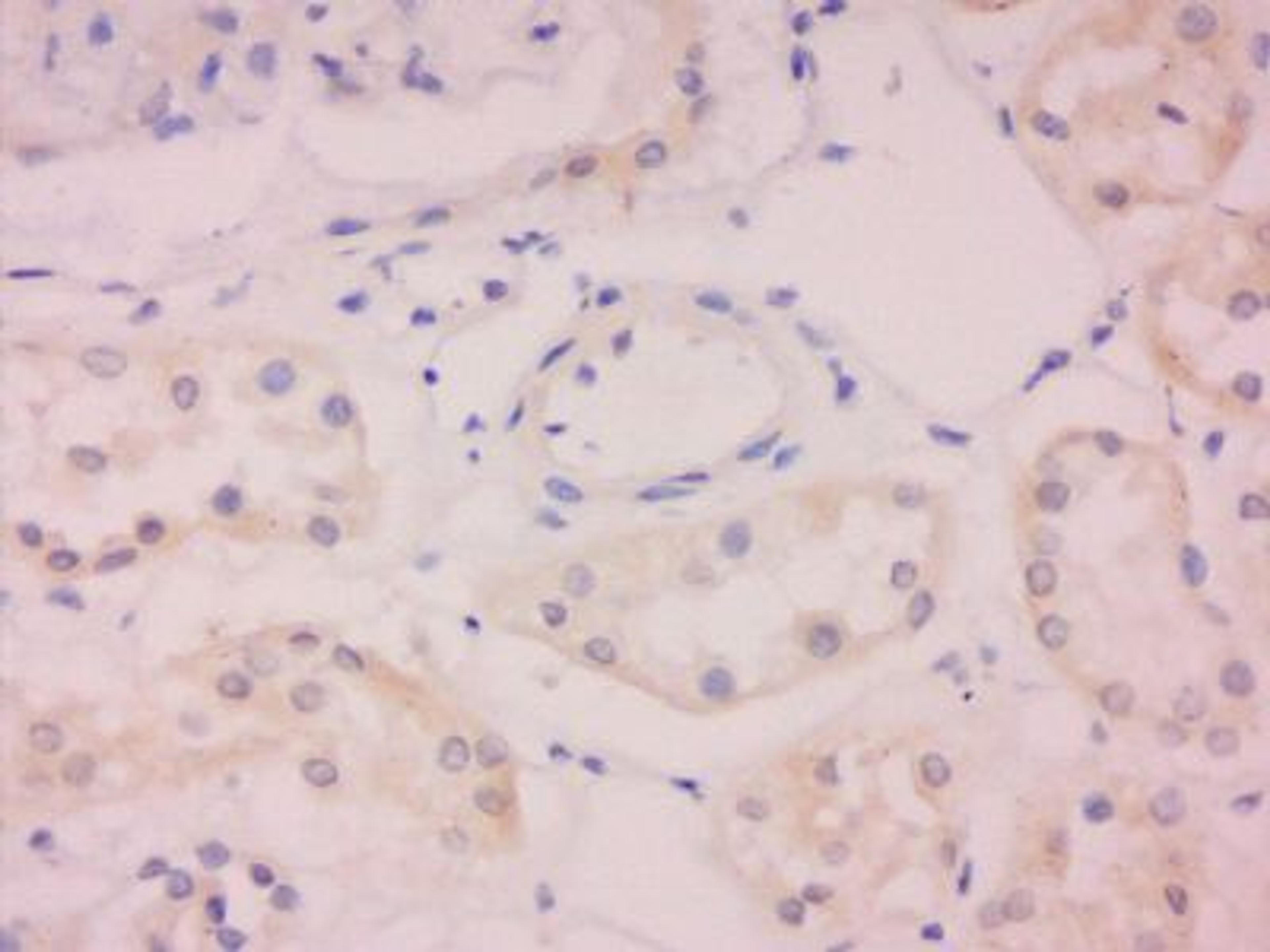 Immunohistochemical staining of human kidney tissue using Aquaporin 5 antibody.