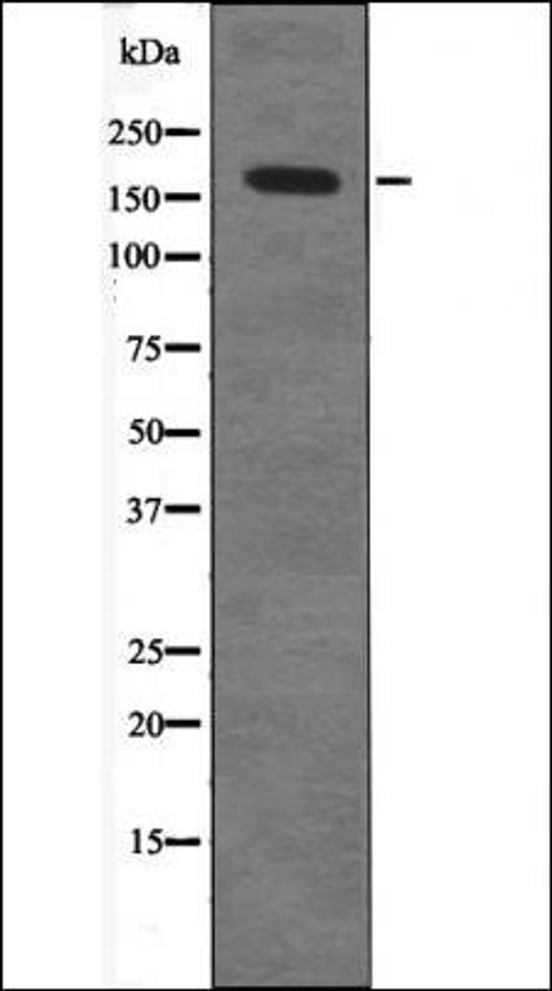 Western blot analysis of 293 whole cell lysates using TOP2A -Phospho-Ser1213- antibody