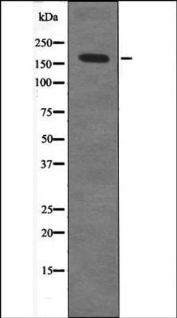 Western blot analysis of 293 whole cell lysates using TOP2A -Phospho-Ser1213- antibody