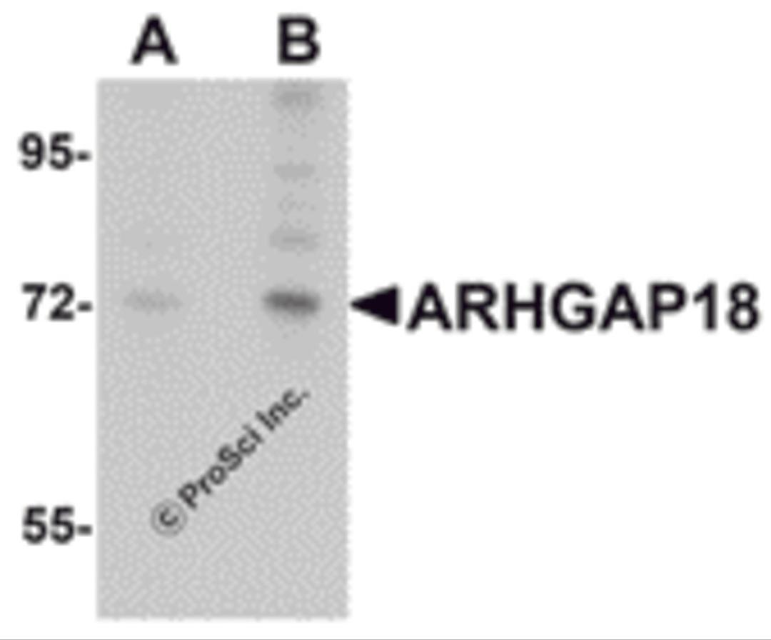 Western blot analysis of ARHGAP18 in 3T3 cell lysate with ARHGAP18 antibody at (A) 1 and (B) 2 μg/mL.