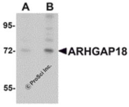 Western blot analysis of ARHGAP18 in 3T3 cell lysate with ARHGAP18 antibody at (A) 1 and (B) 2 μg/mL.