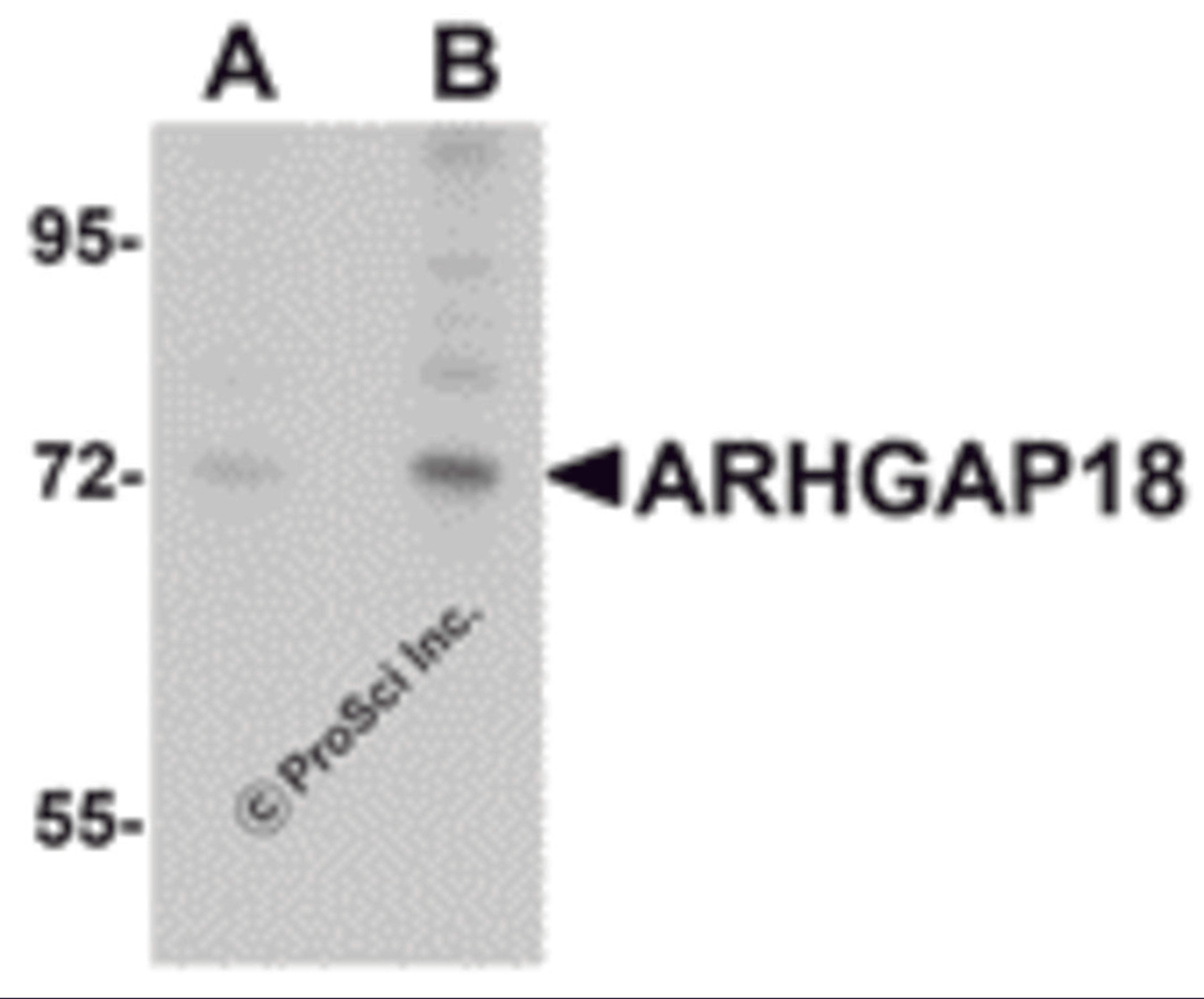 Western blot analysis of ARHGAP18 in 3T3 cell lysate with ARHGAP18 antibody at (A) 1 and (B) 2 μg/mL.