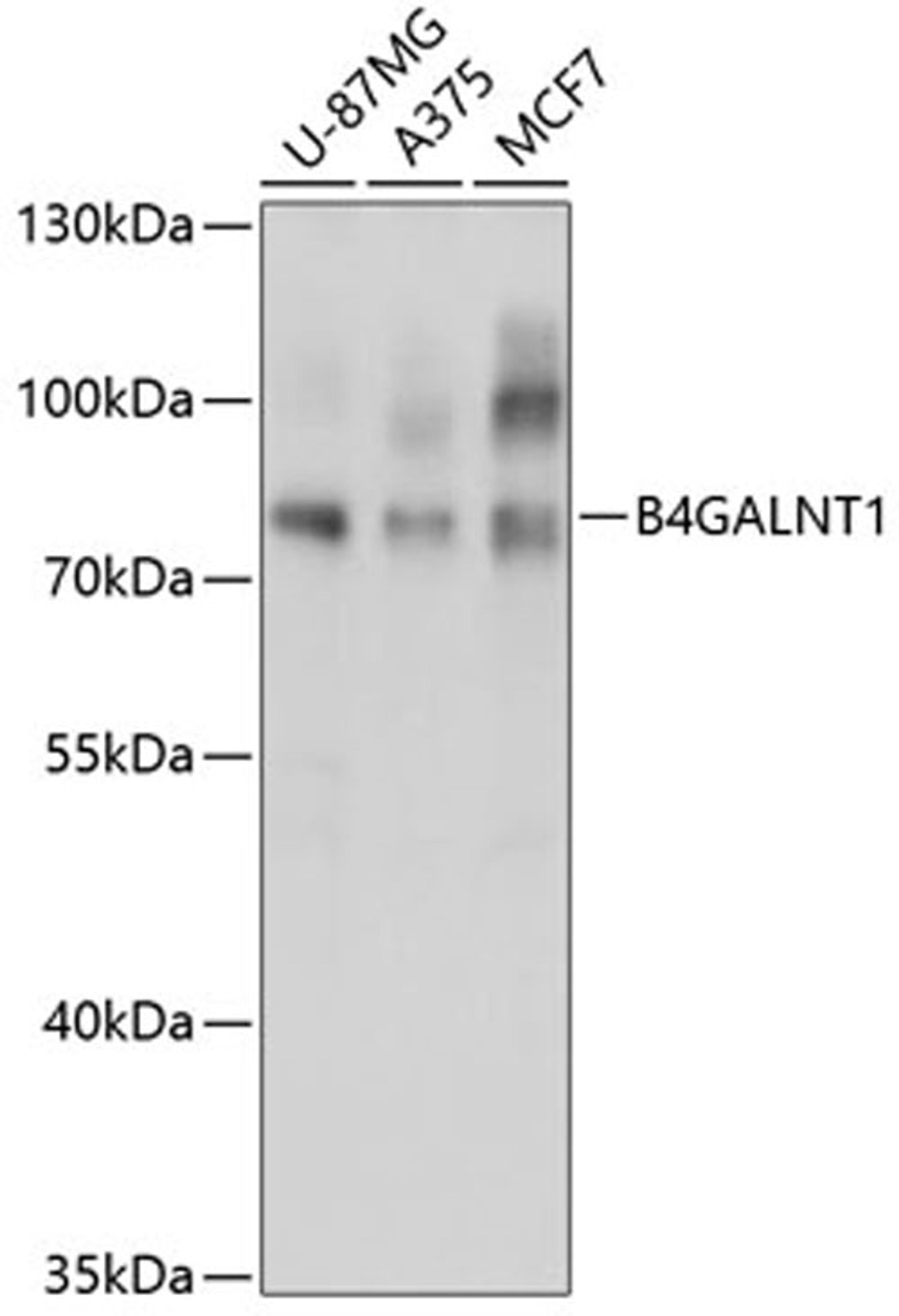 Western blot - B4GALNT1 antibody (A3874)