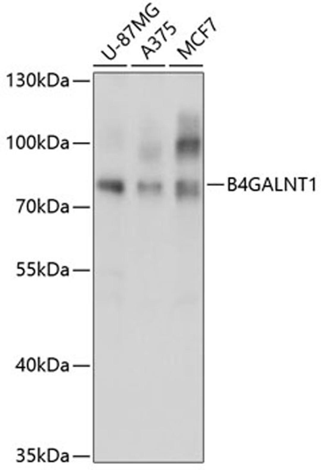 Western blot - B4GALNT1 antibody (A3874)