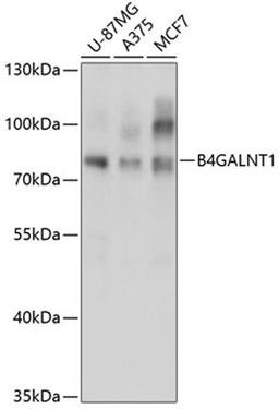 Western blot - B4GALNT1 antibody (A3874)