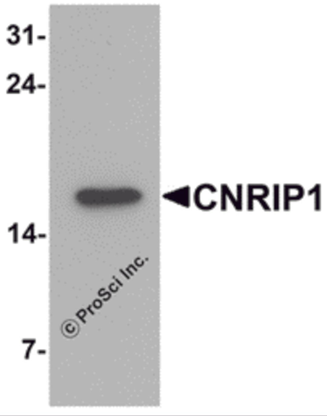 Western blot analysis of CNRIP1 in human brain tissue lysate with CNRIP1 antibody at 1 μg/mL.