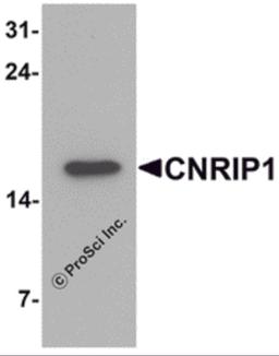 Western blot analysis of CNRIP1 in human brain tissue lysate with CNRIP1 antibody at 1 μg/mL.