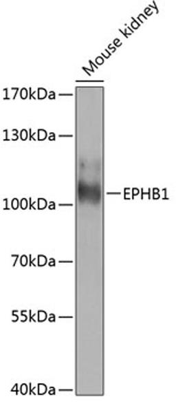 Western blot - EPHB1 antibody (A8415)