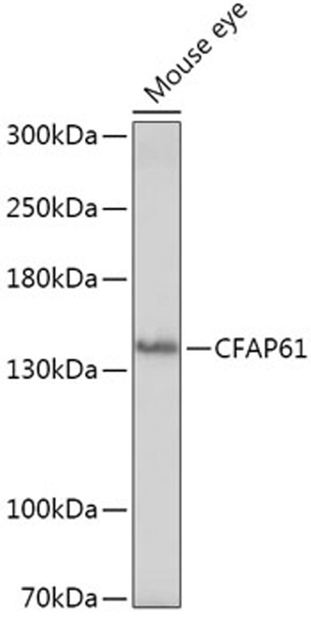 Western blot - CFAP61 antibody (A18194)