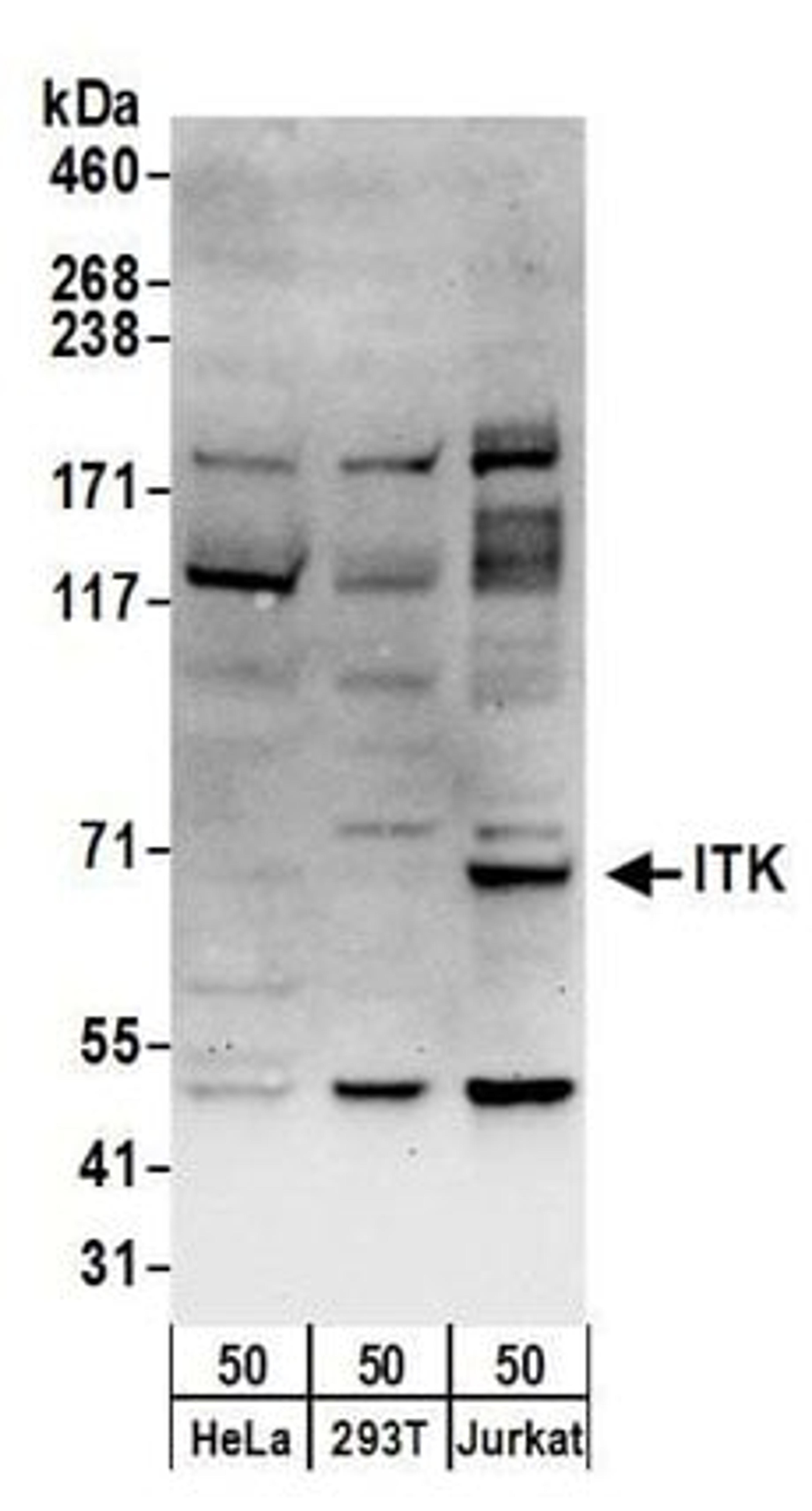 Detection of human ITK by western blot.