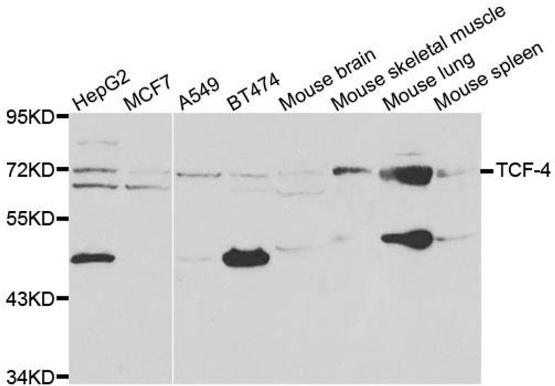 Western blot analysis of extracts of various cell lines using TCF4 antibody