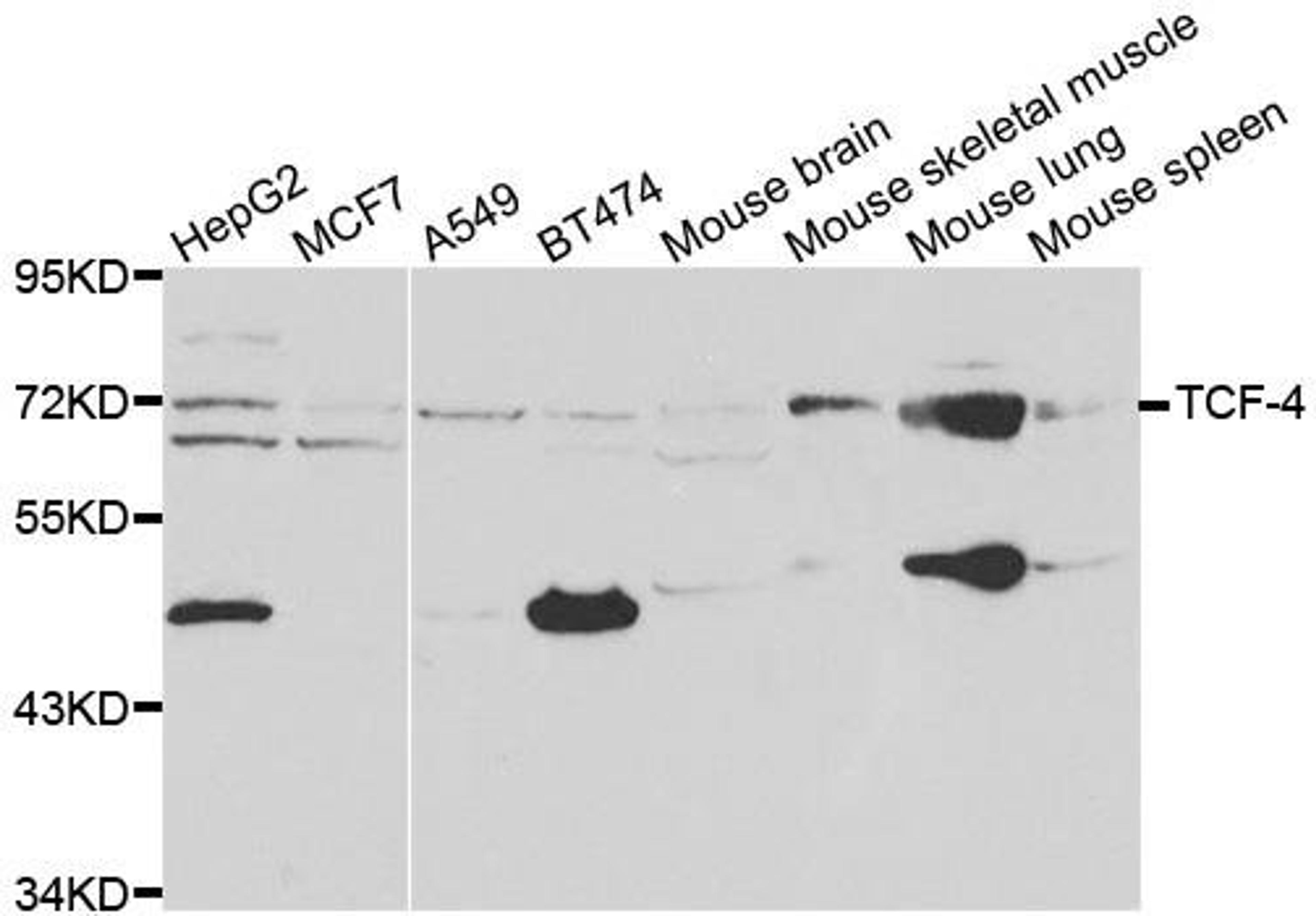 Western blot analysis of extracts of various cell lines using TCF4 antibody