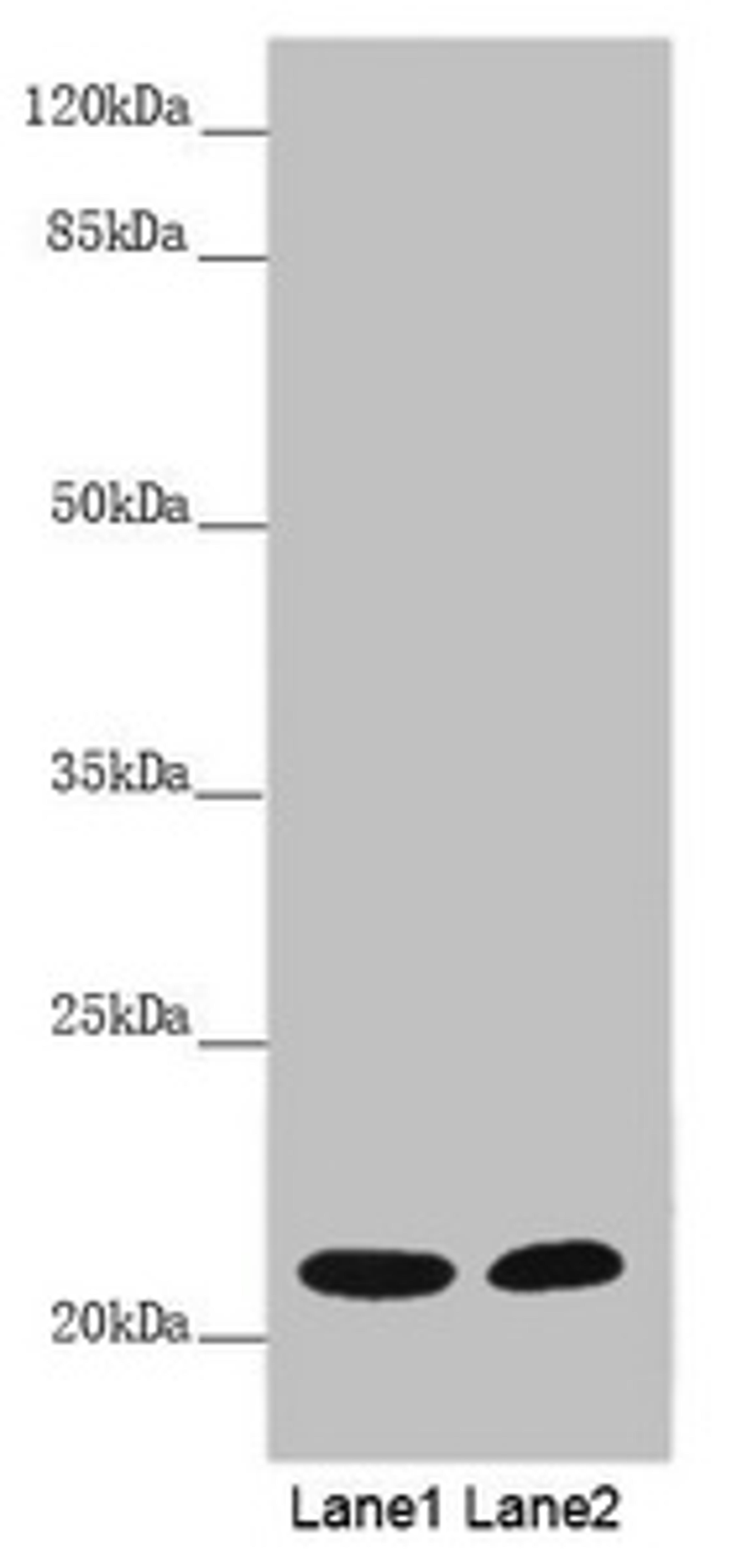 Western blot. All lanes: MYL3 antibody at 5.17 ug/ml. Lane 1: Mouse heart tissue. Lane 2: Rat heart tissue. Secondary. Goat polyclonal to rabbit IgG at 1/10000 dilution. Predicted band size: 22 kDa. Observed band size: 22 kDa.