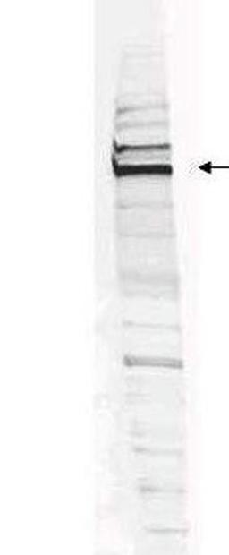 Western blot analysis of HEK293 whole cell lysate using WHIP antibody