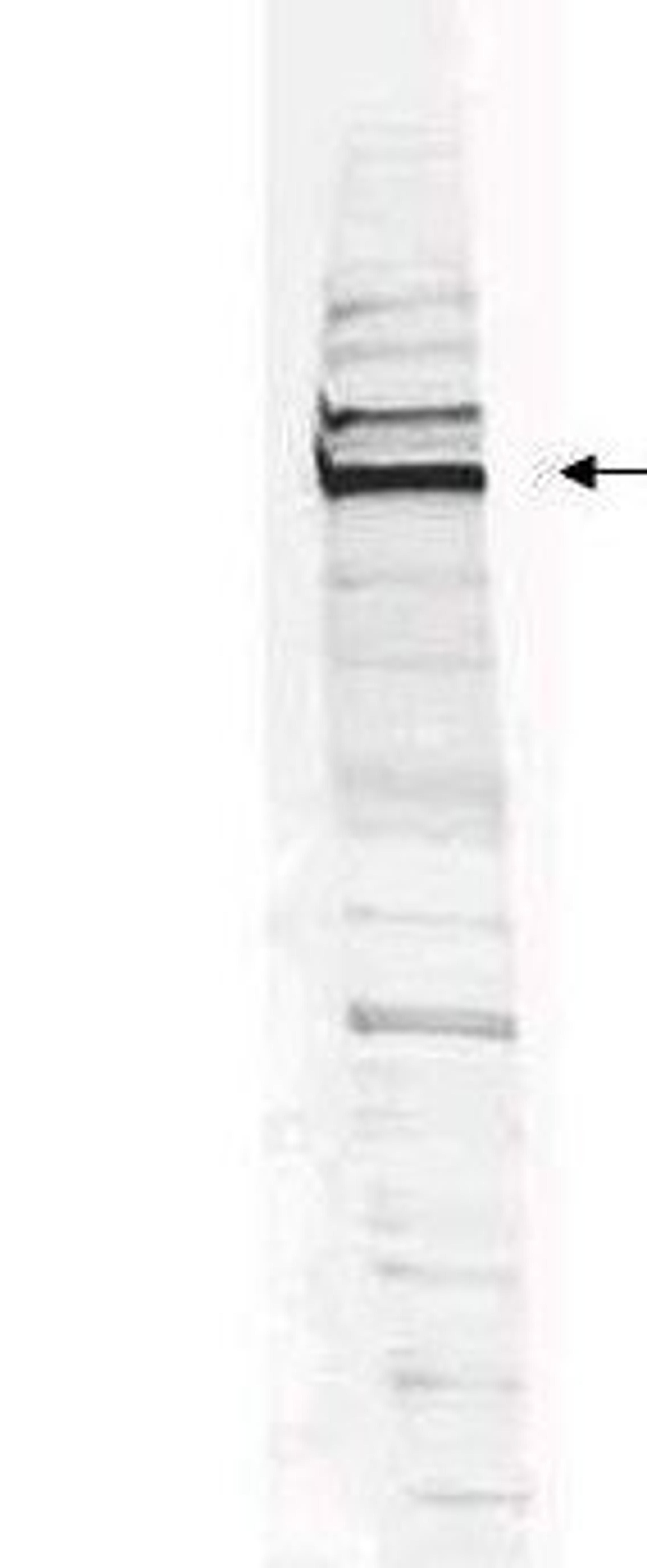 Western blot analysis of HEK293 whole cell lysate using WHIP antibody