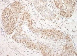 Detection of human TFIP11 by immunohistochemistry.