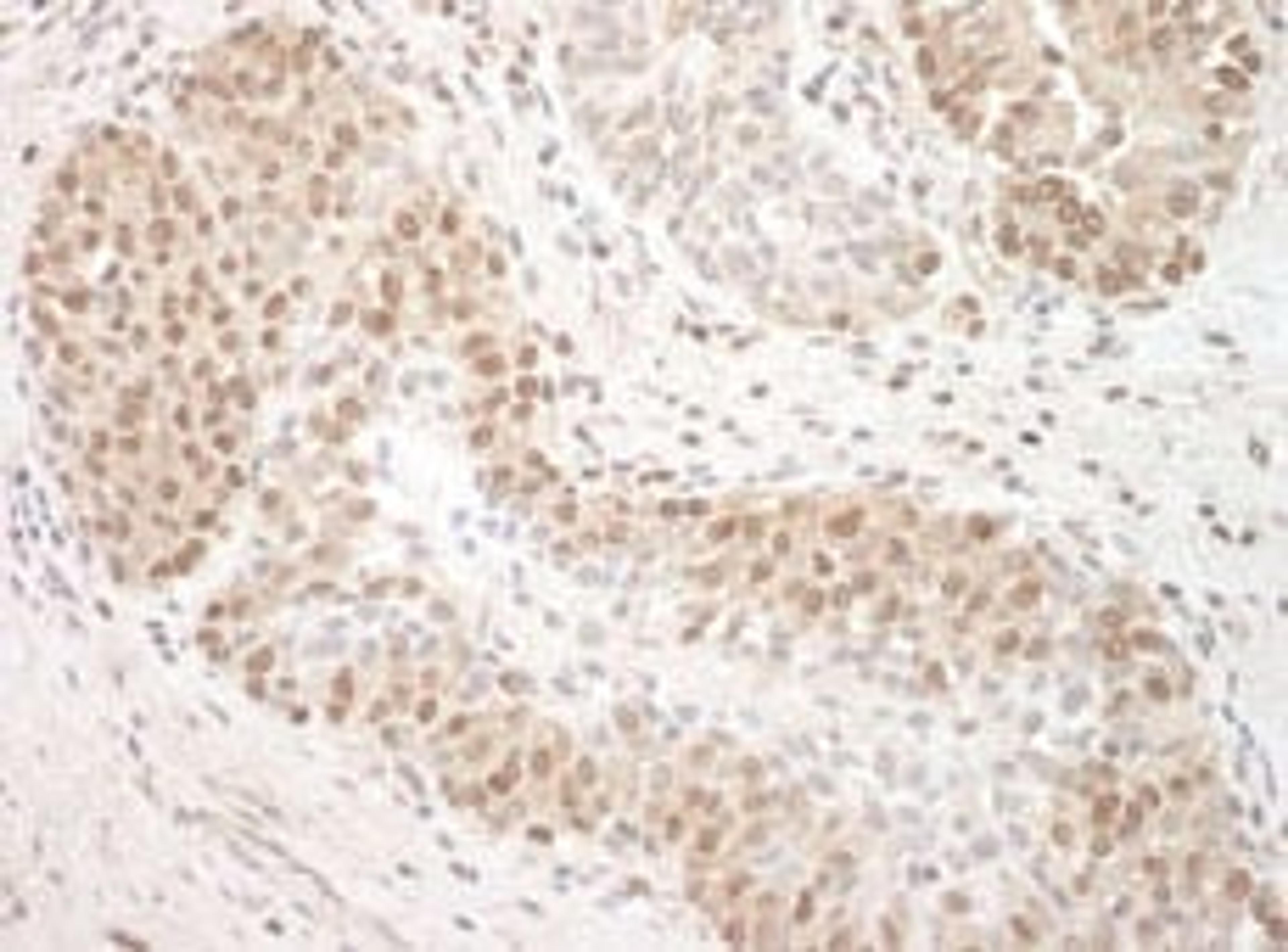 Detection of human TFIP11 by immunohistochemistry.