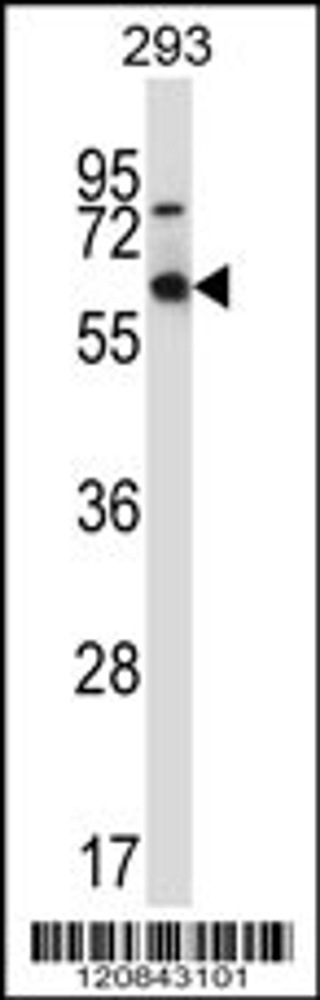 Western blot analysis in 293 cell line lysates (35ug/lane).