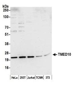 Detection of human and mouse TMED10 by western blot.