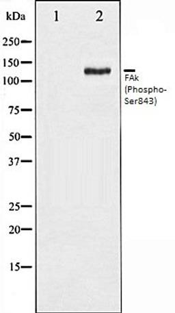 Western blot analysis of HepG2 whole cell lysates using FAK (Phospho-Ser843) antibody, The lane on the left is treated with the antigen-specific peptide.