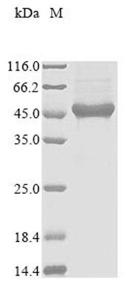 (Tris-Glycine gel) Discontinuous SDS-PAGE (reduced) with 5% enrichment gel and 15% separation gel.