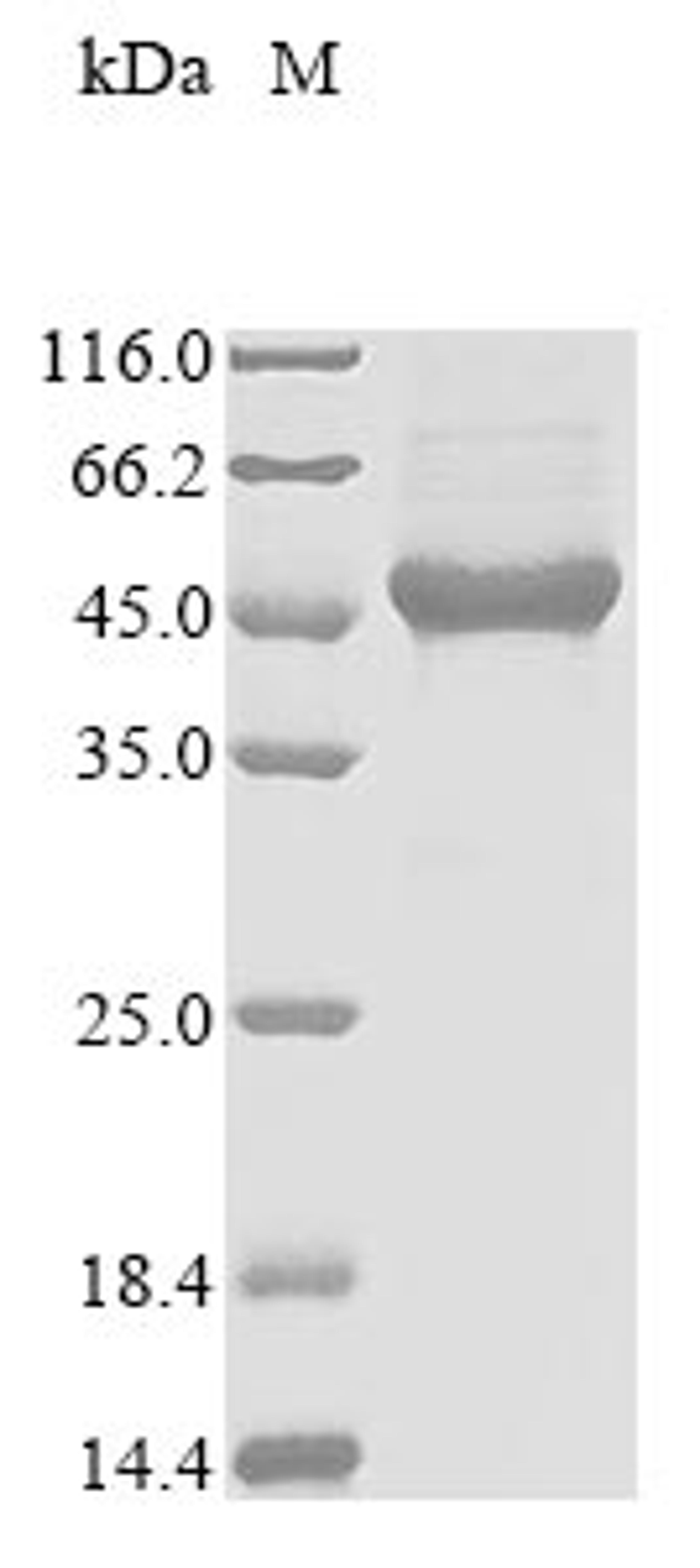 (Tris-Glycine gel) Discontinuous SDS-PAGE (reduced) with 5% enrichment gel and 15% separation gel.