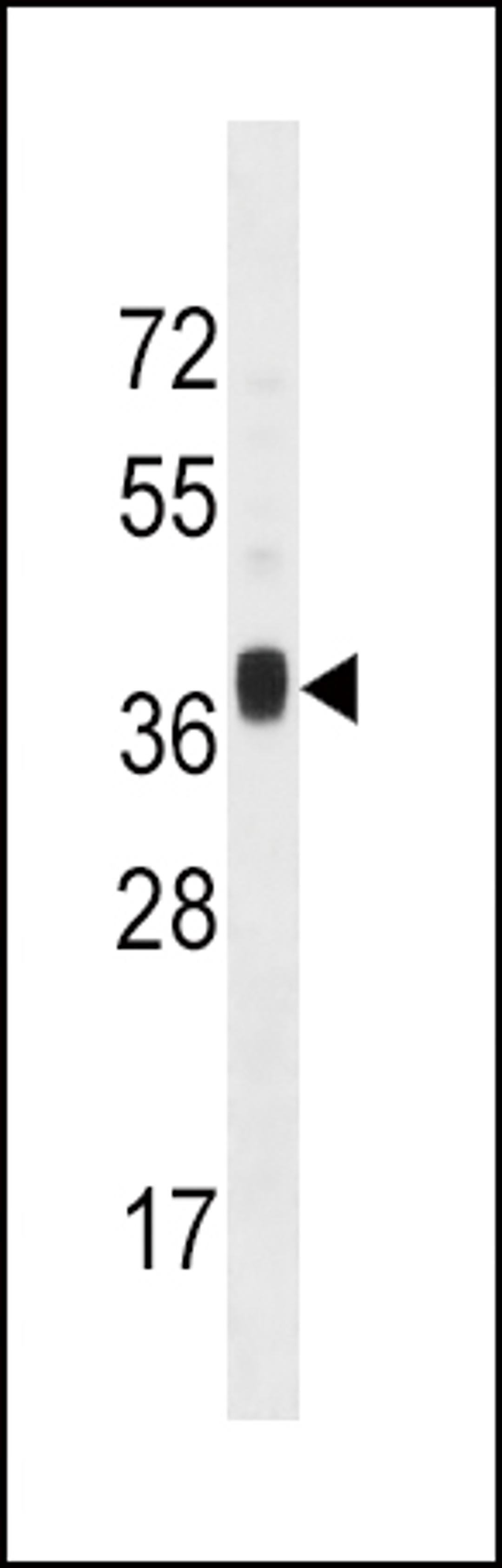 Western blot analysis in mouse liver tissue lysates (35ug/lane).