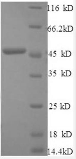 (Tris-Glycine gel) Discontinuous SDS-PAGE (reduced) with 5% enrichment gel and 15% separation gel.